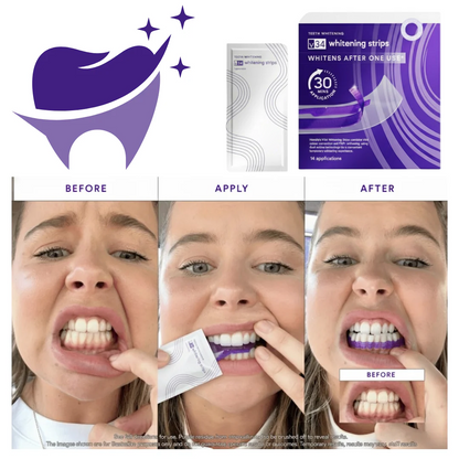 SmileV34 Whitening Strips: ‘’The Fast Track to a Stunning Smile!‘’