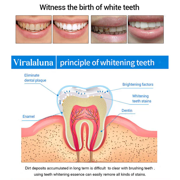 BUY 1 GET 1 FREE | Teeth Whitening Essence
